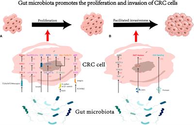 Gut microbiota: key facilitator in metastasis of colorectal cancer